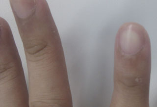 看「指甲」就知健康?变色,凹陷恐患慢性病日期:2011.07.29