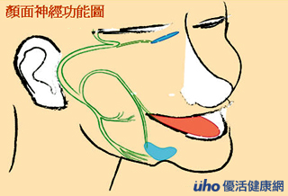 中风?压力加熬夜,颜面神经麻痹上身