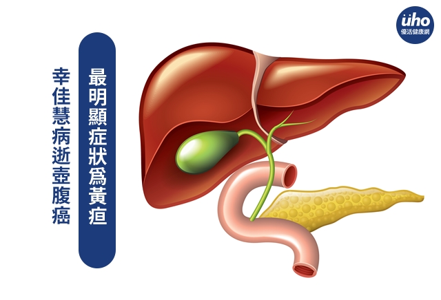 幸佳慧病逝壶腹癌 最明显症状为黄疸