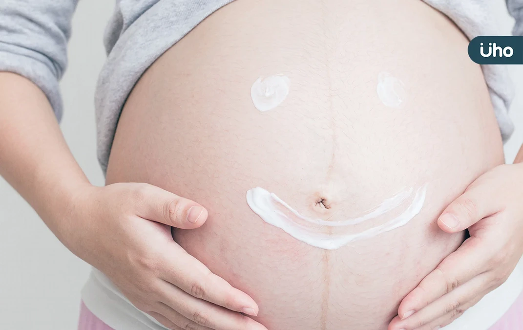 妊娠紋會自己消失嗎？孕婦必學「除紋3招」：懷孕●●週開始擦乳液