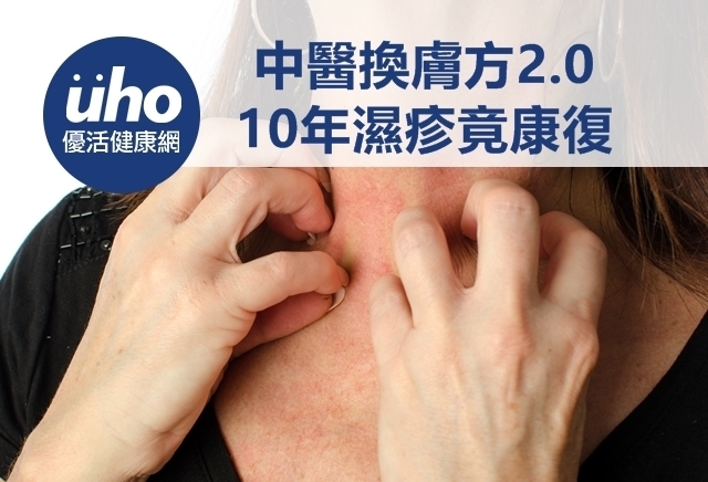 中醫換膚方2.0　10年濕疹竟康復