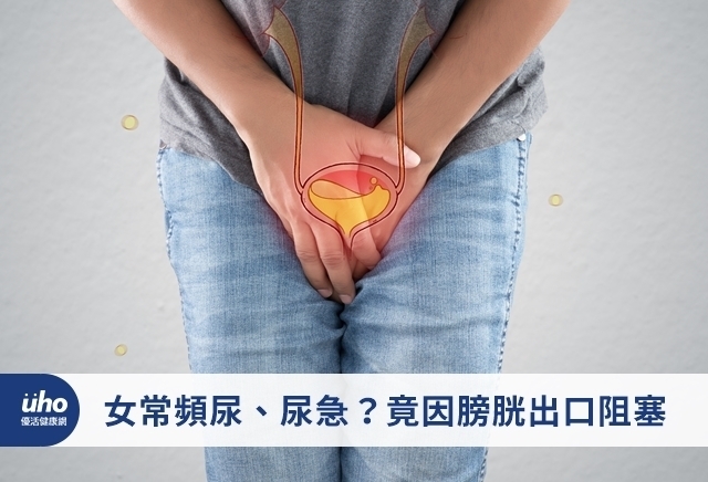 女常頻尿、尿急？竟因膀胱出口阻塞