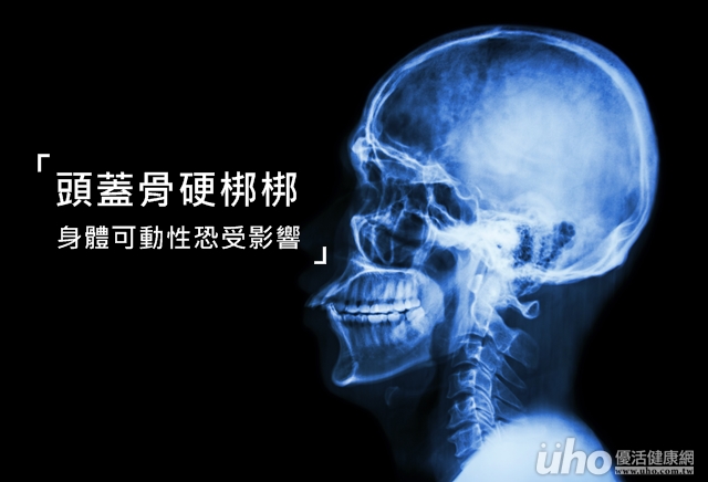 頭蓋骨硬梆梆身體可動性恐受影響 Uho優活健康網