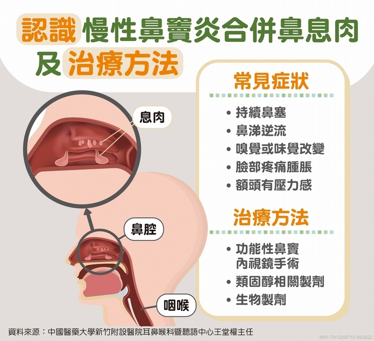 新藥可縮小鼻息肉體積，減7成復發率