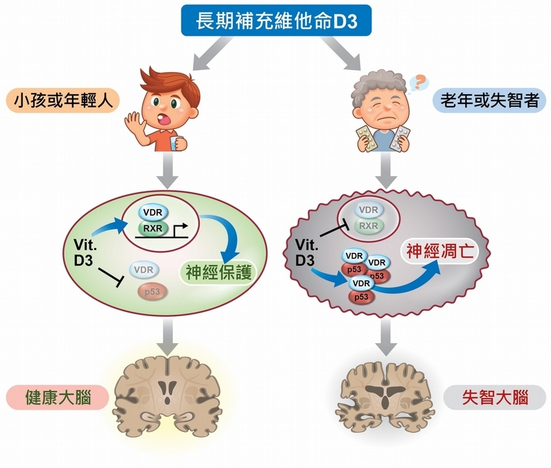 患者補充維生素D，加速大腦神經退化