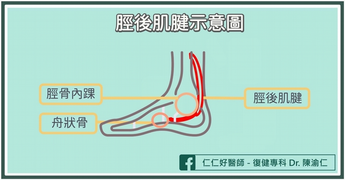 什麼是「脛後肌腱」？