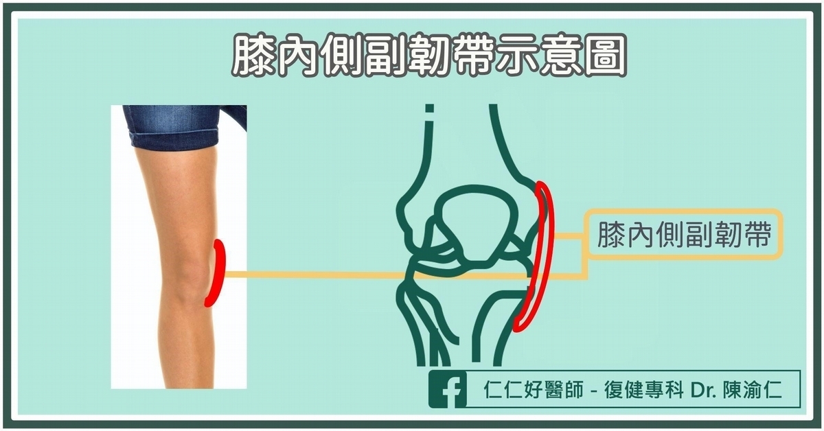 什麼是「膝內側副韌帶」？