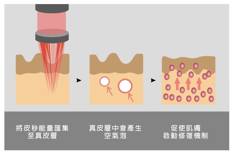 一次改善5種肌膚問題