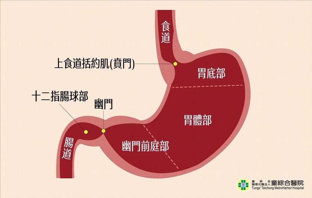 幽門桿菌感染者大多無症狀