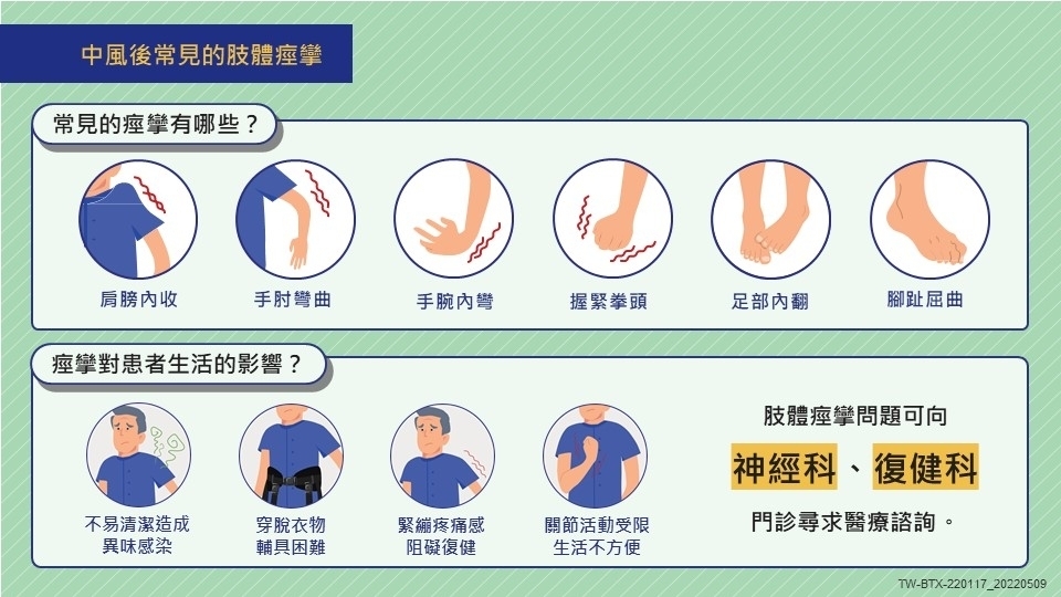 腦中風肌肉痙攣常見症狀