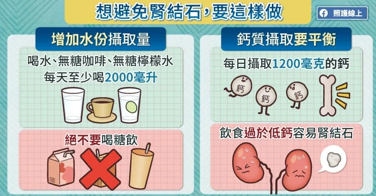 腎結石5大飲食策略