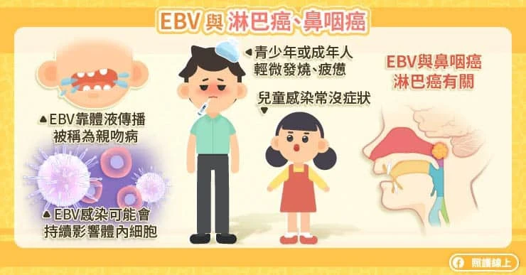 EBV與淋巴癌、鼻咽癌