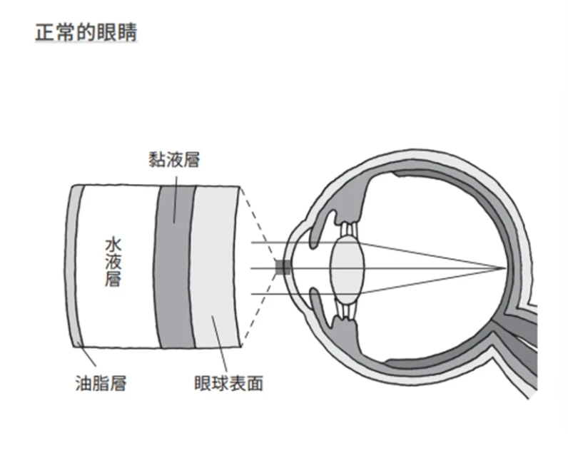 眼睛乾澀好疲勞，拼命點人工淚液？醫教「毛巾熱敷法」5分鐘能舒緩