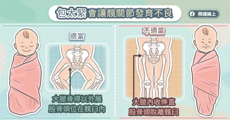 髖關節發育不良的原因