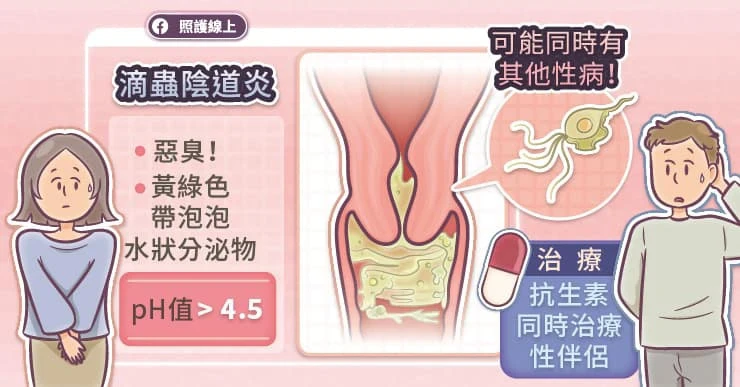 3. 滴蟲陰道炎（Trichomoniasis）