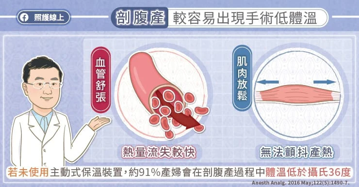 剖腹產較易「手術低體溫」