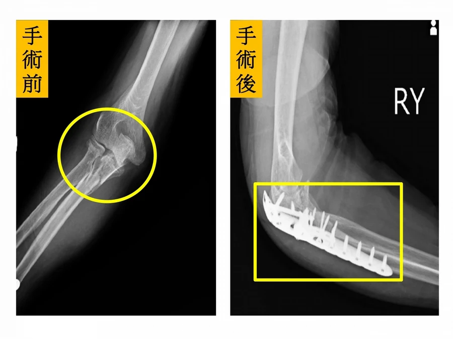 治療因嚴重程度有所不同