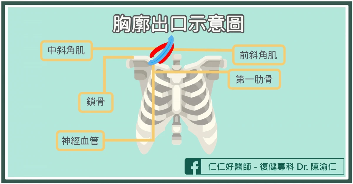 胸廓出口症候群是什麼？