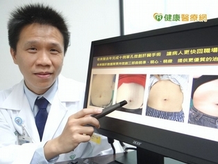 單孔微創肝臟手術 恢復更快風險低