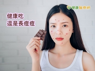 飲食與青春痘有關嗎? 醫:因人而異