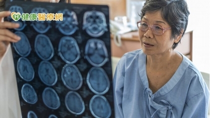 1/10中風病友一年內復發 醫籲做好「這」些事
