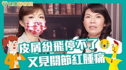 關節腫痛頭皮發紅 當心乾癬性關節炎上身!