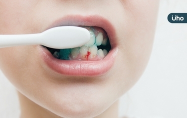 刷牙流血驚藏「掉牙」危機！醫警告「牙周病」別以為不痛就沒事
