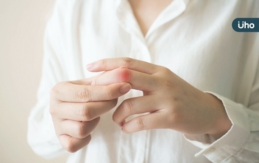 手指關節常疼痛⋯止痛藥真會吃到洗腎！醫揭改吃「中藥」降5成風險