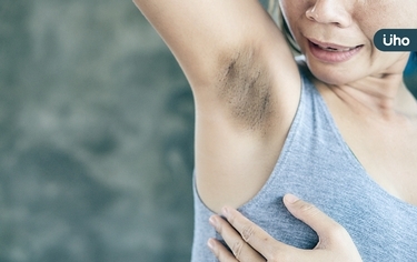 「腋下黑黑的」先別急著找醫美!帶你看「3情況」變黑恐是癌症前兆