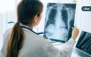肺癌治療新方向?台大研究揭「神經是癌細胞幫兇」首創1招斷電療法