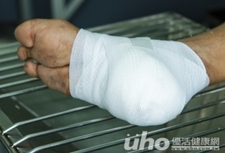 糖尿足部病變 吸菸惡化恐截肢