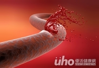 打針腫好幾天 童竟患血友病