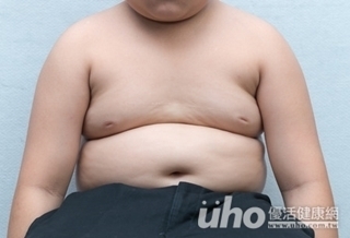 3個孩子1個胖 易致憂鬱