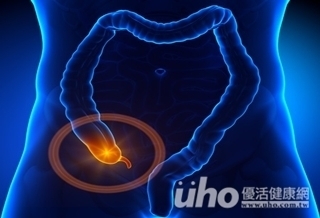 食慾差、發燒　闌尾炎恐致死