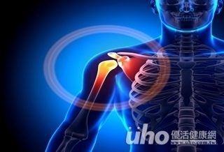 肩痛喊「卡」 玻尿酸助一臂之力