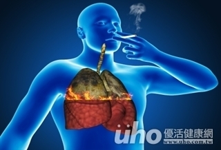 揪出肺癌　45歲起每年一次X光
