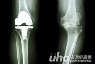 3好處 快讓導航帶路換關節