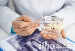 亂牙難取模?3D列印有辦法