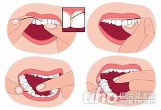 口腔想顧好　牙刷牙線不可少