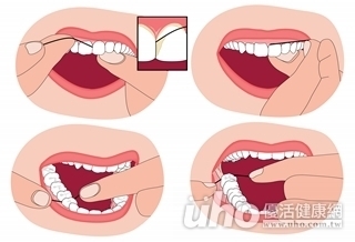 口腔想顧好 牙刷牙線不可少