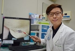 腋窩長濕疹 久不癒竟癌變!