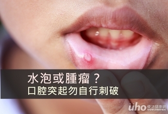 水泡或腫瘤？口腔突起勿自行刺破