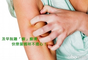 及早脫離「癬」境 快樂當媽咪不擔心!