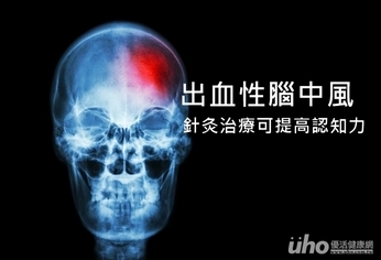 出血性腦中風　針灸治療可提高認知力