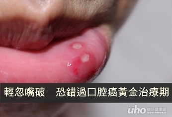 輕忽嘴破 恐錯過口腔癌黃金治療期