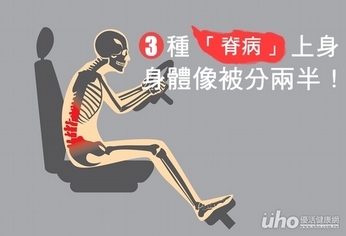 3種「脊病」上身 身體像被分兩半!
