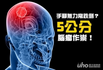 手腳無力常跌倒?5公分腦瘤作祟!