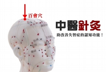 中醫針灸 助改善失智症的認知功能!