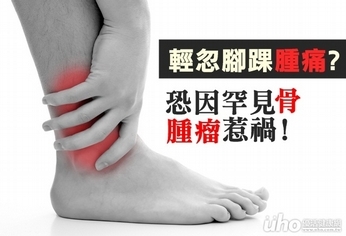 腳踝腫痛莫輕忽 恐因罕見骨腫瘤惹禍