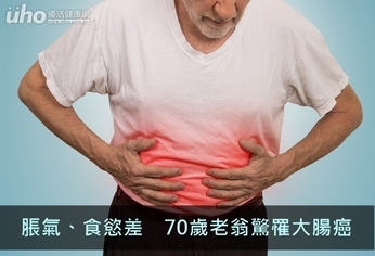 脹氣、食慾差　70歲老翁驚罹大腸癌